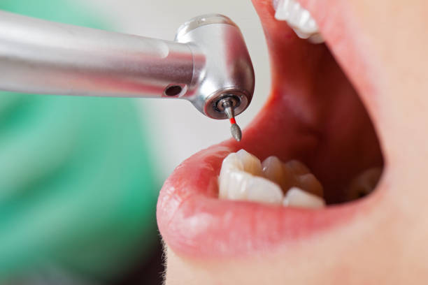 Best Emergency Dentist for Knocked-Out Tooth in Cold Spring, NY